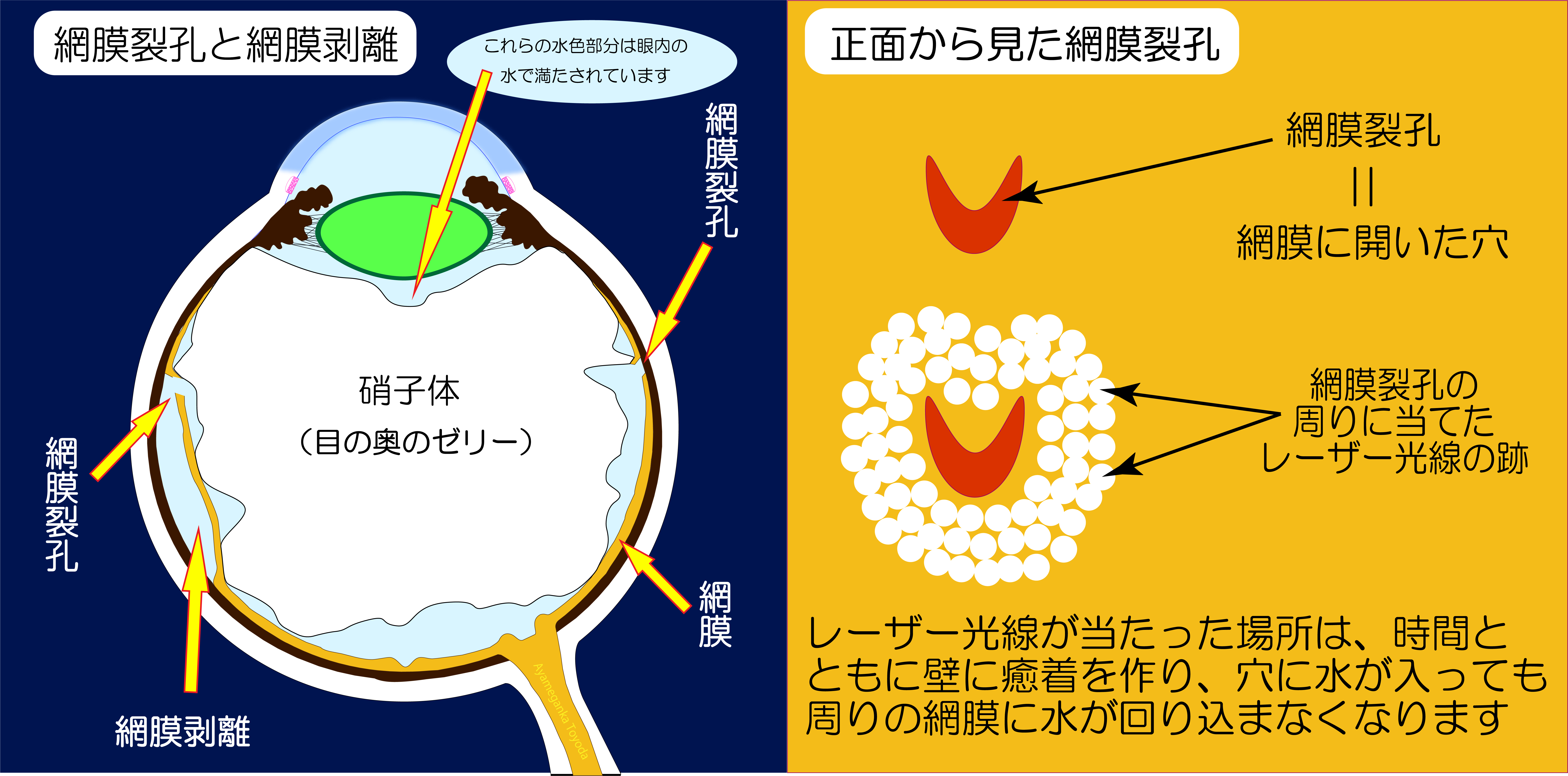 当時のメディア報道・掲載写真